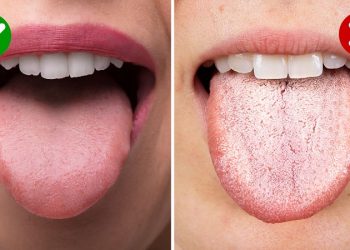 जिब्रोले खोल्छ स्वास्थ्यको रहस्य