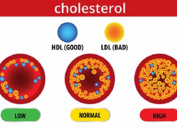 कोलेस्ट्रोल के हो ? के नखाने ? कसरी कम गर्ने ?