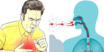 स्याङ्जामा १९७ क्षयरोगका बिरामी, ७ को मृत्यु