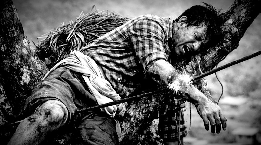 भीरकोटको करेन्ट दुर्घटना लुकाउँदै स्याङ्जा प्रहरी, शनिबार करेन्ट लाग्दा खनाल गम्भीर घाइते